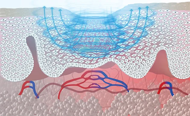 Magnetic stimulation