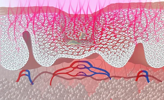 Optical stimulation